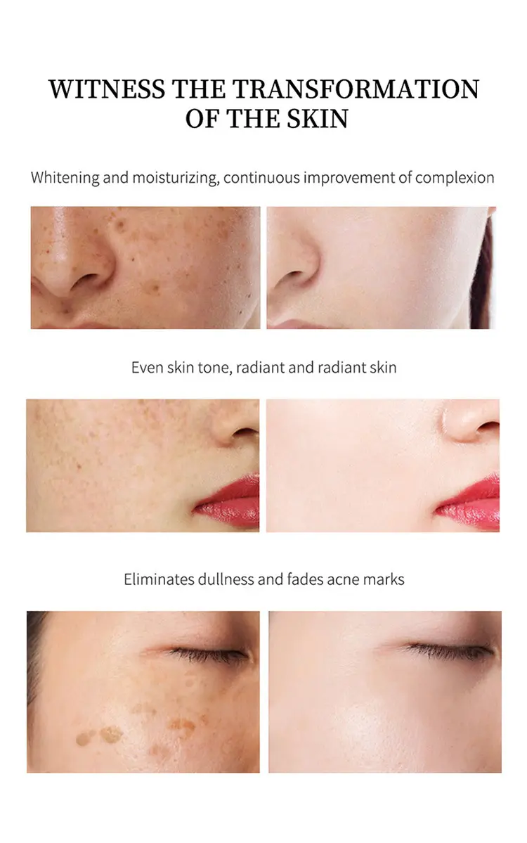 Picture of YOUBUY Whitening and Freckle Removing Cream 20gm 