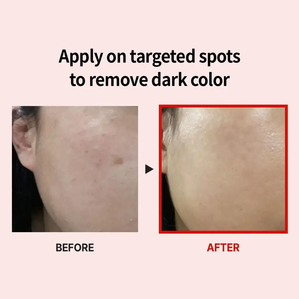 Picture of Medi Peel Melanon X Cream 30ml 