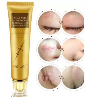 Picture of Pei Mei Scar And Acne Mark Removal Gel Ointment 30 G 