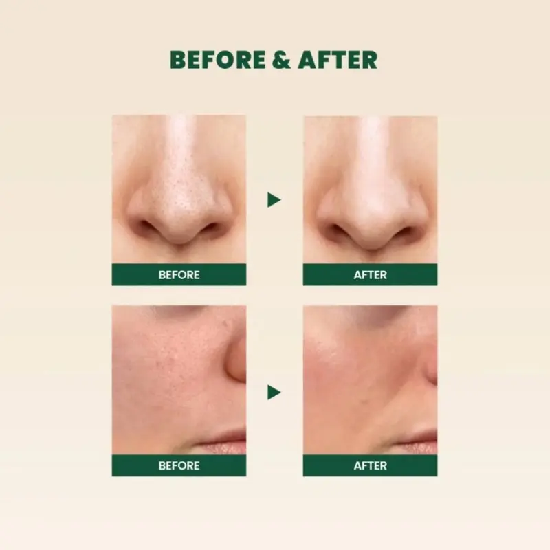 Picture of KSECRET SEOUL 1988 Cleansing Foam : Pine Cica 1% + Probiotics, 150ml/5.07fl.oz. Off White