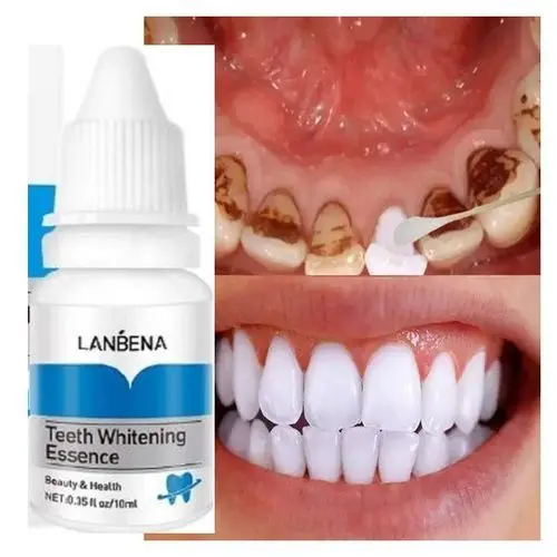 Picture of Lanbena Teeth Whitening Essence 10ml new(Glow N Touch Beauty)