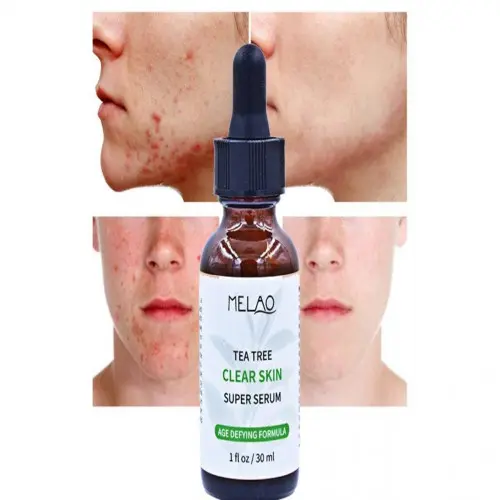 Picture of Melao Tea Tree Clear Skin Super Serum 30ml new(Glow N Touch Beauty)