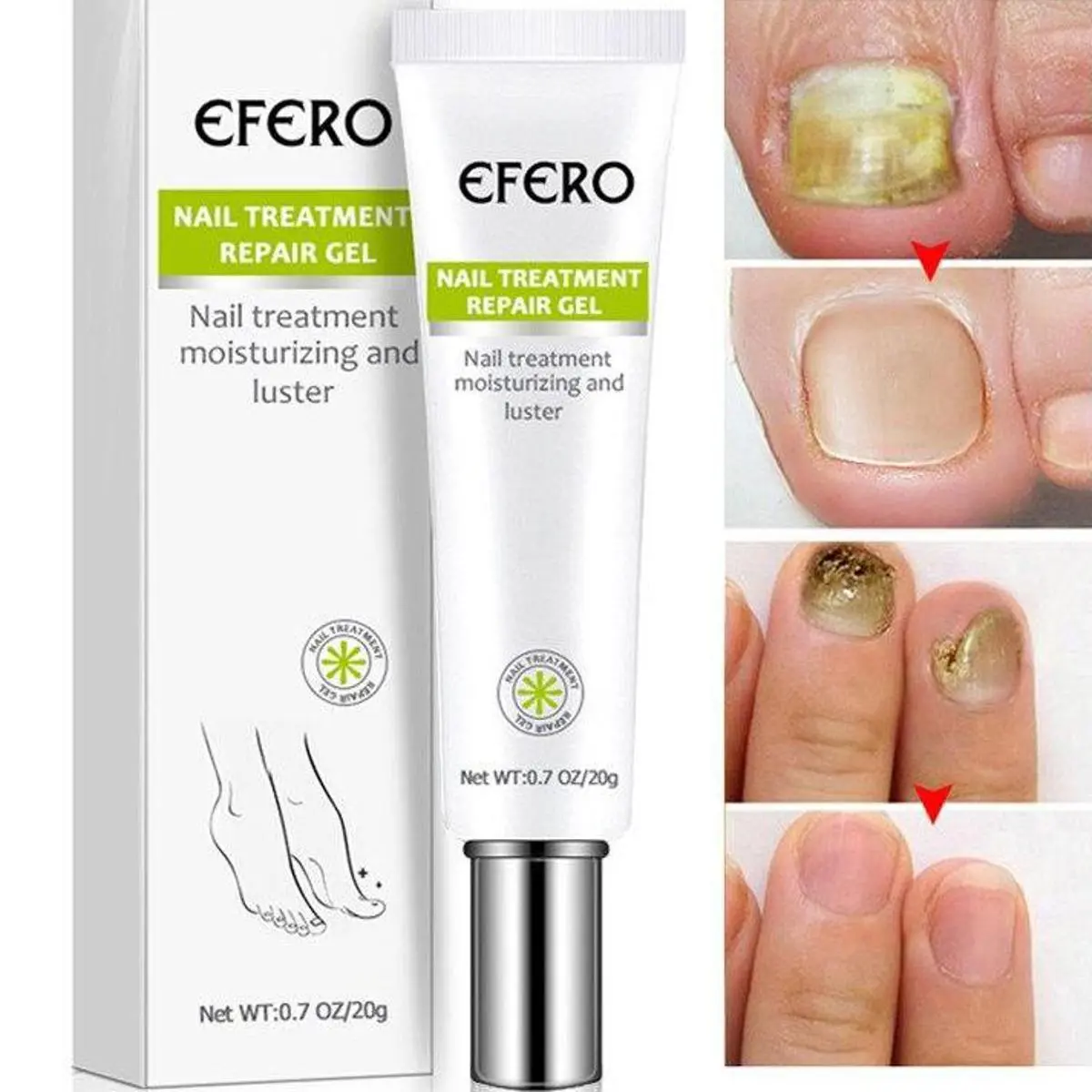Picture of Efero Nail Repair Treatment Gel Fungus Cream-20gm Efero Nail Repair Treatment Gel Fungus Cream-20gm new