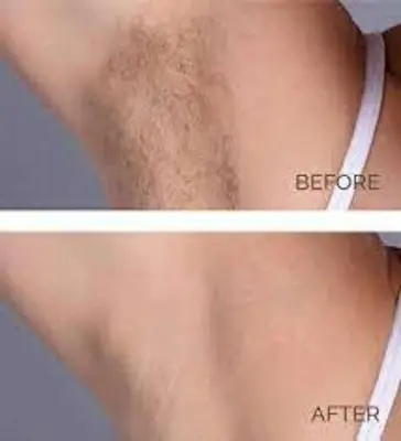 Picture of BEAUTE 3D Underarm Whitening Cure Cream new