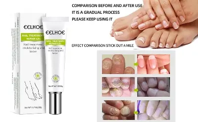 Picture of EELHOE Nail Fungus Repair Essence Gel Nail Treatment Repair Cream Gel-20gm NEW