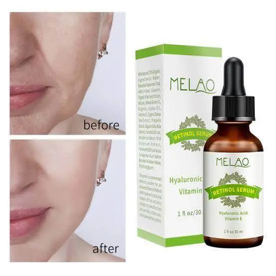 Picture of Melao Retinol Serum - Hyaluronic Acid Vitamin E-30ml NEW