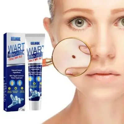Picture of Warts Remover Ointment Wart Treatment Cream Skin Tag Remover Ointment - Face - SL Disc NEW
