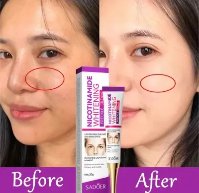 Picture of SADOER Niacinamide Whitening Freckle Cream Effectively Removes Melasma Lightens Black Spots Acne Marks Brightens Skin Care-20gm