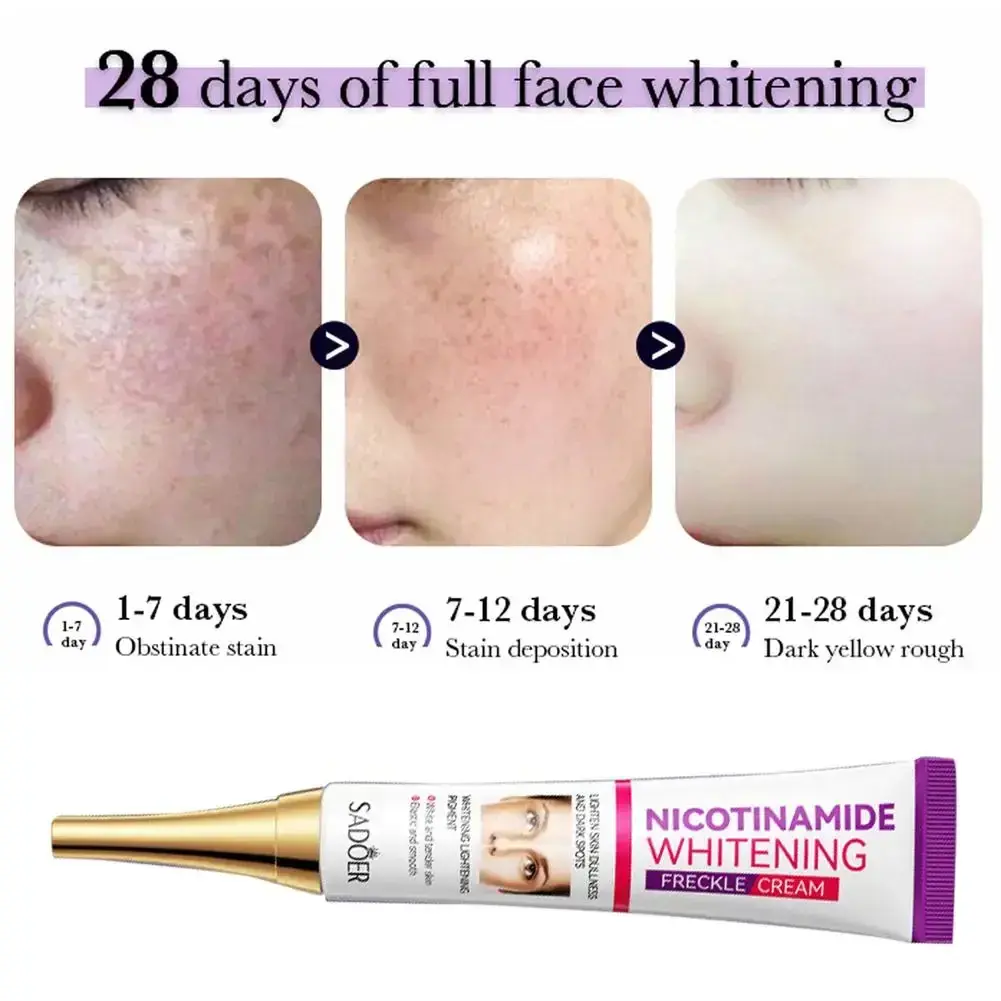 Picture of SADOER Niacinamide Whitening Freckle Cream Effectively Removes Melasma Lightens Black Spots Acne Marks Brightens Skin Care-20gm