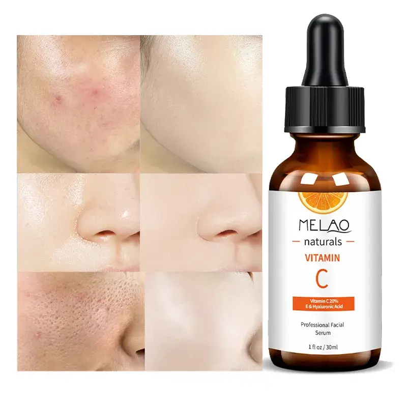 Picture of MELAO Vitamin C Serum Hydrating Whitening Spot Correcting Serum Moisturizing Anti-Wrinkle Firming Serum Face Care Serum 30 ml