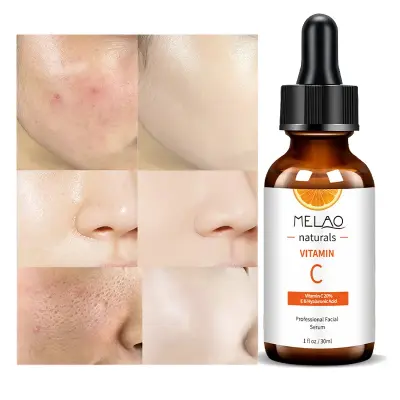 Picture of MELAO Vitamin C Serum Hydrating Whitening Spot Correcting Serum Moisturizing Anti-Wrinkle Firming Serum Face Care Serum 30 ml