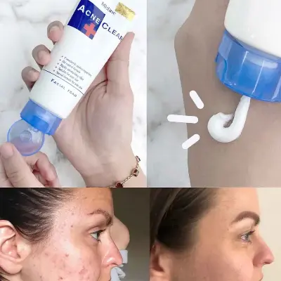 Picture of Mistine Acne Clear Face Wash Facial Foam 85 gm