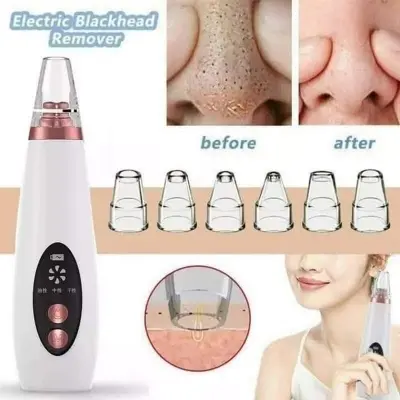 Picture of Electric Face Suction Removal Machine Pore Cleaner black Head Vacuum Pimple Black Head Remover