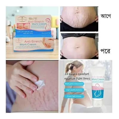 Picture of Aichun Beauty Anti Stretch Mark Cream – Intensive Skin Treatment for Improvement & Elimination