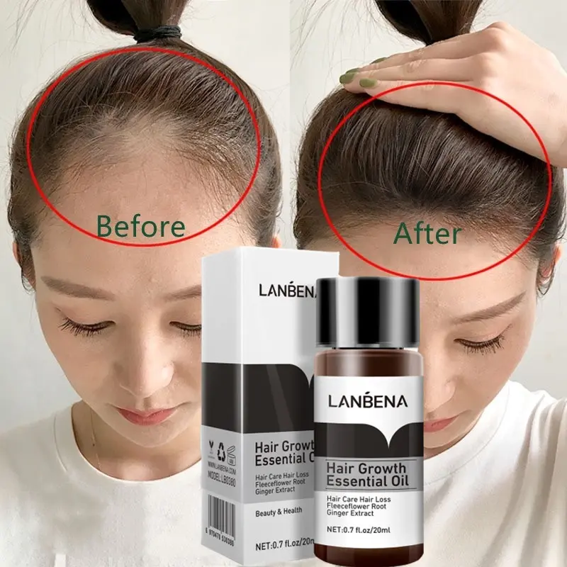 Picture of LANBENA Premium Hair Growth Essence Oil 20ml - Volumizing & Anti-Hair Loss Treatment for All Hair Types
