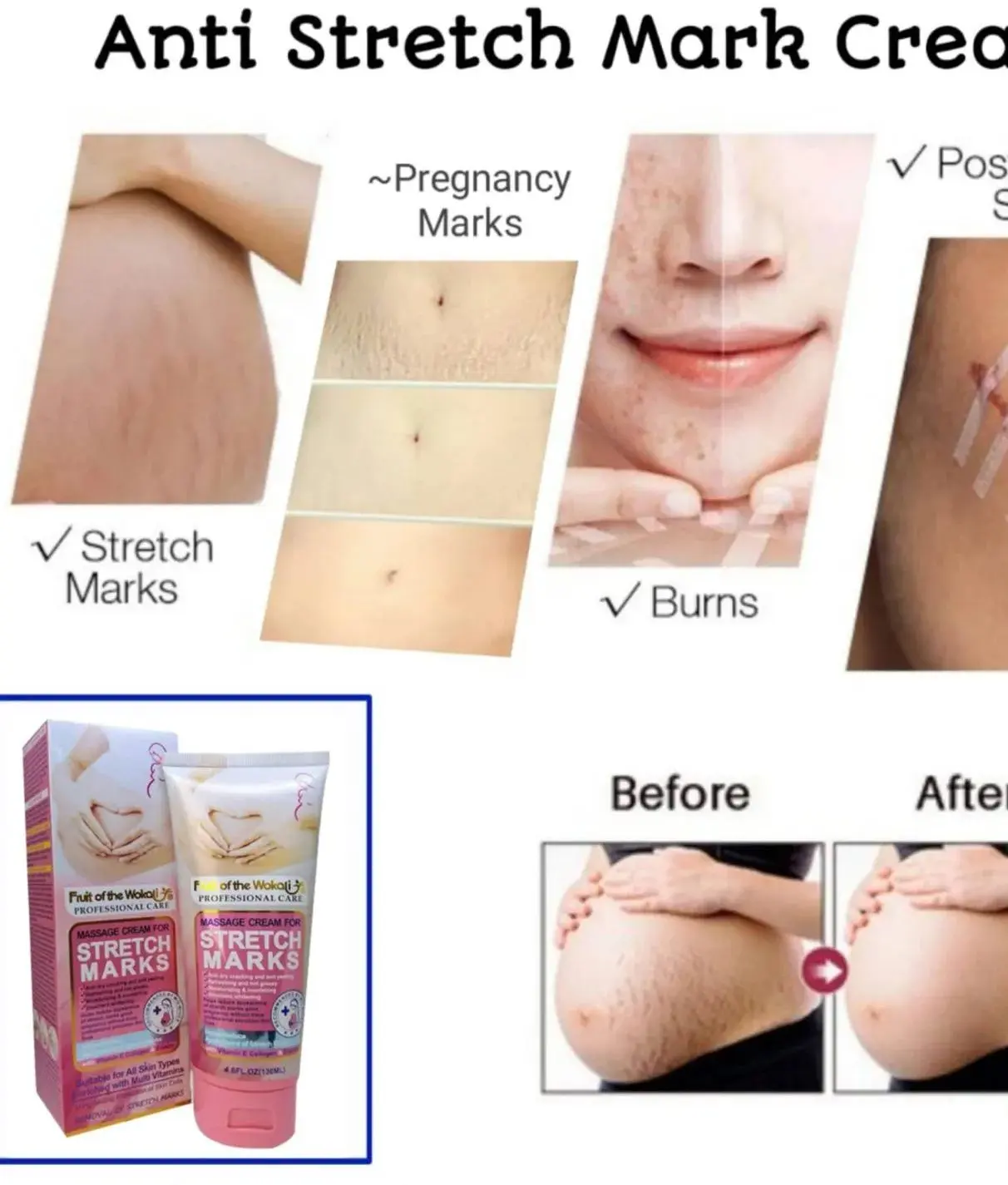 Picture of WOKALI Professional Care Massage Cream for Stretch Marks 130ml