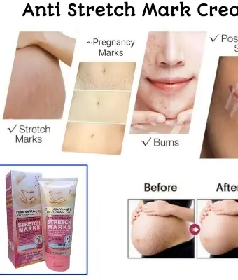 Picture of WOKALI Professional Care Massage Cream for Stretch Marks 130ml
