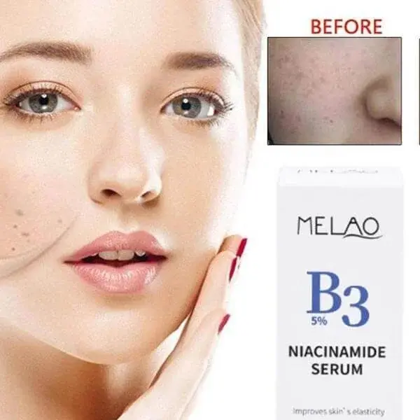 Picture of Melao Salicylic Acid 2% / B3 5% Niacinamide / 2% Alpha Arbutin / Vitamin C All Types melao Serum 30ml(B3 5% Niacinamide)