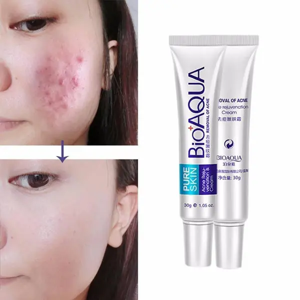 Picture of BIOAQUA Face Skin Care Acne Anti-Wrinkle Removal Cream Spots Scar Blemish Marks 30g
