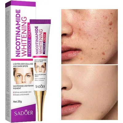 Picture of SADOER Whitening and Freckle Removal Cream Moisturizing Moisturizing and Fading Niacinamide Cream-20gm NEW