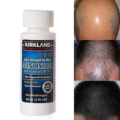 Picture of Kirkland Minoxidil 5% For Beard & Hair Growth 2025