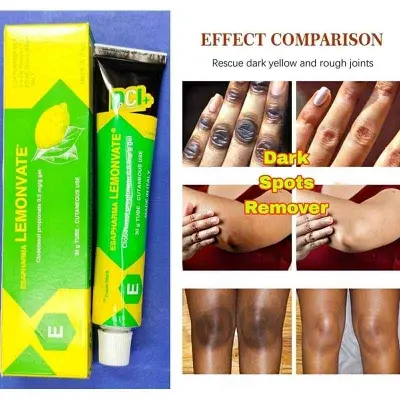 Picture of Lemonvate Cream - 30gm (Italy)