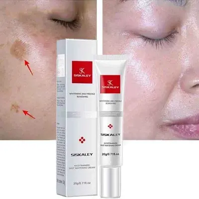 Picture of Youbuy Freckle Whitening Cream 20g Pigmentation Remover Dark Spot Remover Anti Freckles Whitening Cream new