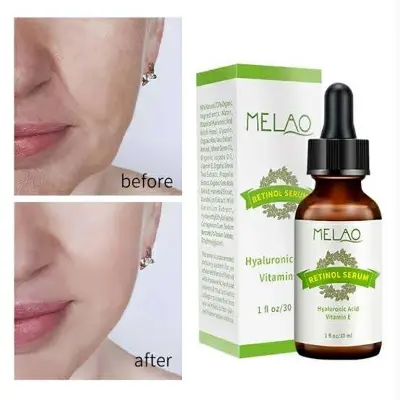 Picture of MELAO Retinol Hyaluronic Acid Vitamin E Serum 30ml new