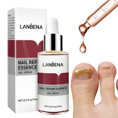 Picture of LANBENA Nail Repair Essence Serum Fungus Treatment Nail Removal Onychomycosis-15ml  new(Glow N Touch Beauty)