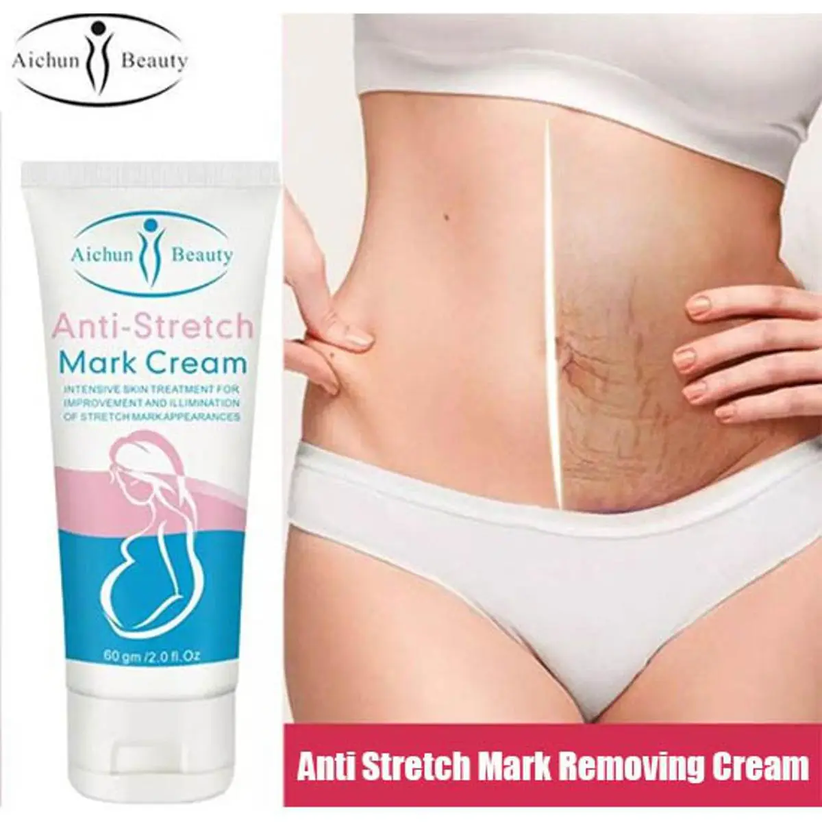 Picture of Anti Stretch Mark Cream 60 gm