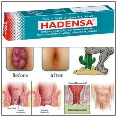 Picture of Indian Hadensa Ointment For Piles  Man & Women - 20gm