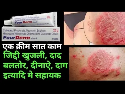 Picture of Fourderm Cream 20g India