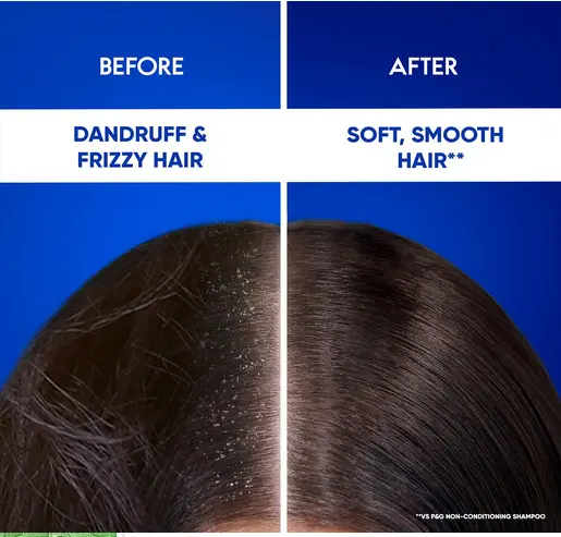 Picture of Head & Shoulders 2-in-1 Cool Menthol Anti Dandruff Shampoo + Conditioner for Women & Men, With Almond Milk (1 L)