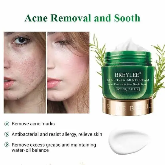 Picture of Breylee Acne Treatment Cream for Skin Care 20 Gms