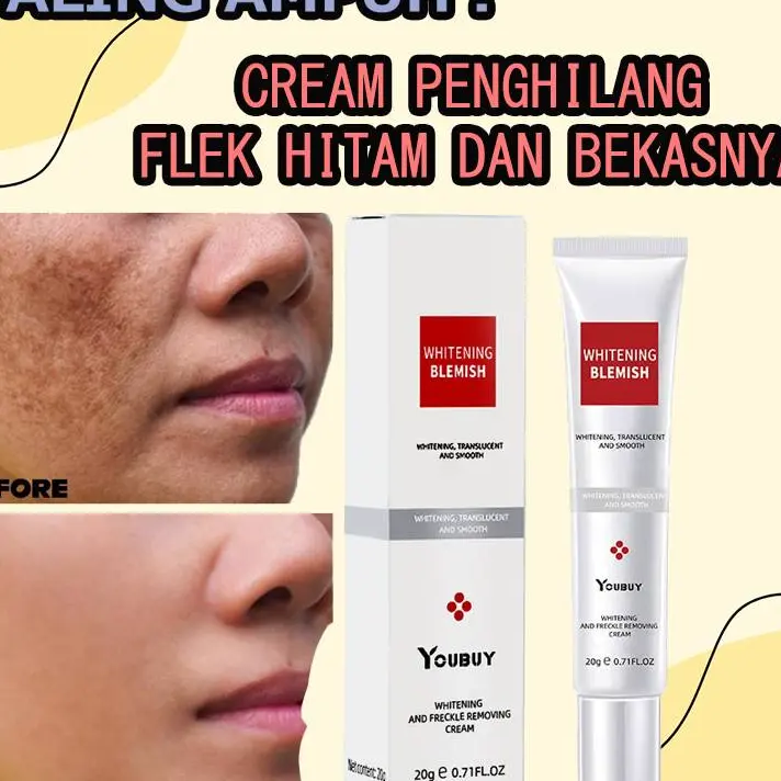 Picture of YOUBUY Whitening and Freckle Removing Cream 20 gm