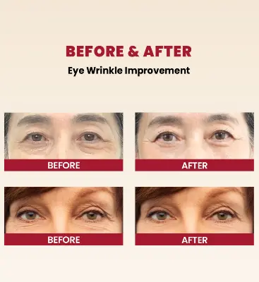 Picture of KSECRET SEOUL 1988 EYE CREAM : RETINAL LIPOSOME 4% + FERMENTED BEAN 30ML