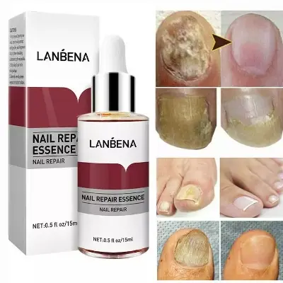 Picture of LANBENA Nail Repair Essence - 15ml