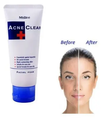 Picture of Mistine Acne Clear Face Wash Facial Foam 85 ml