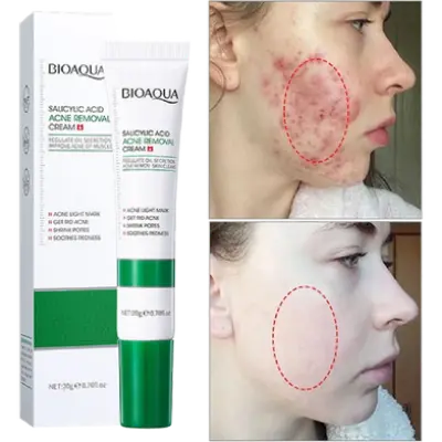 Picture of BIOAQUA Natural Salicylic Acid for Acne Face Cream Cleaning Pores Repairing Acne Spots Controlling Moisturizing Skin Remove Acne Marks-20gm