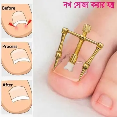 Picture of Nail Care Machine for Nail Repair Professional Salon Quality Manicure Pedicure Tool Kit