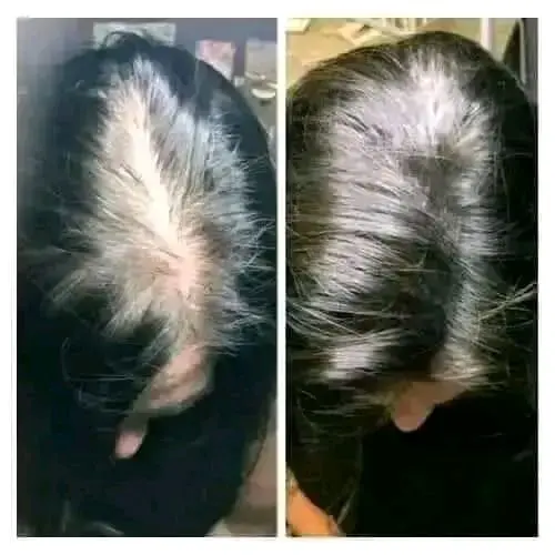 Picture of Update Organic Hair Fall Oil Treatment for strong,soft, shiny & wavy hair - 175ml