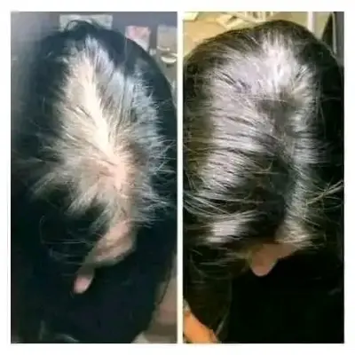 Picture of Update Organic Hair Fall Oil Treatment for strong,soft, shiny & wavy hair - 175ml