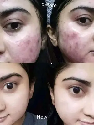 Picture of Collagen Plus Vitamin E Day & Night Cream - 40gm