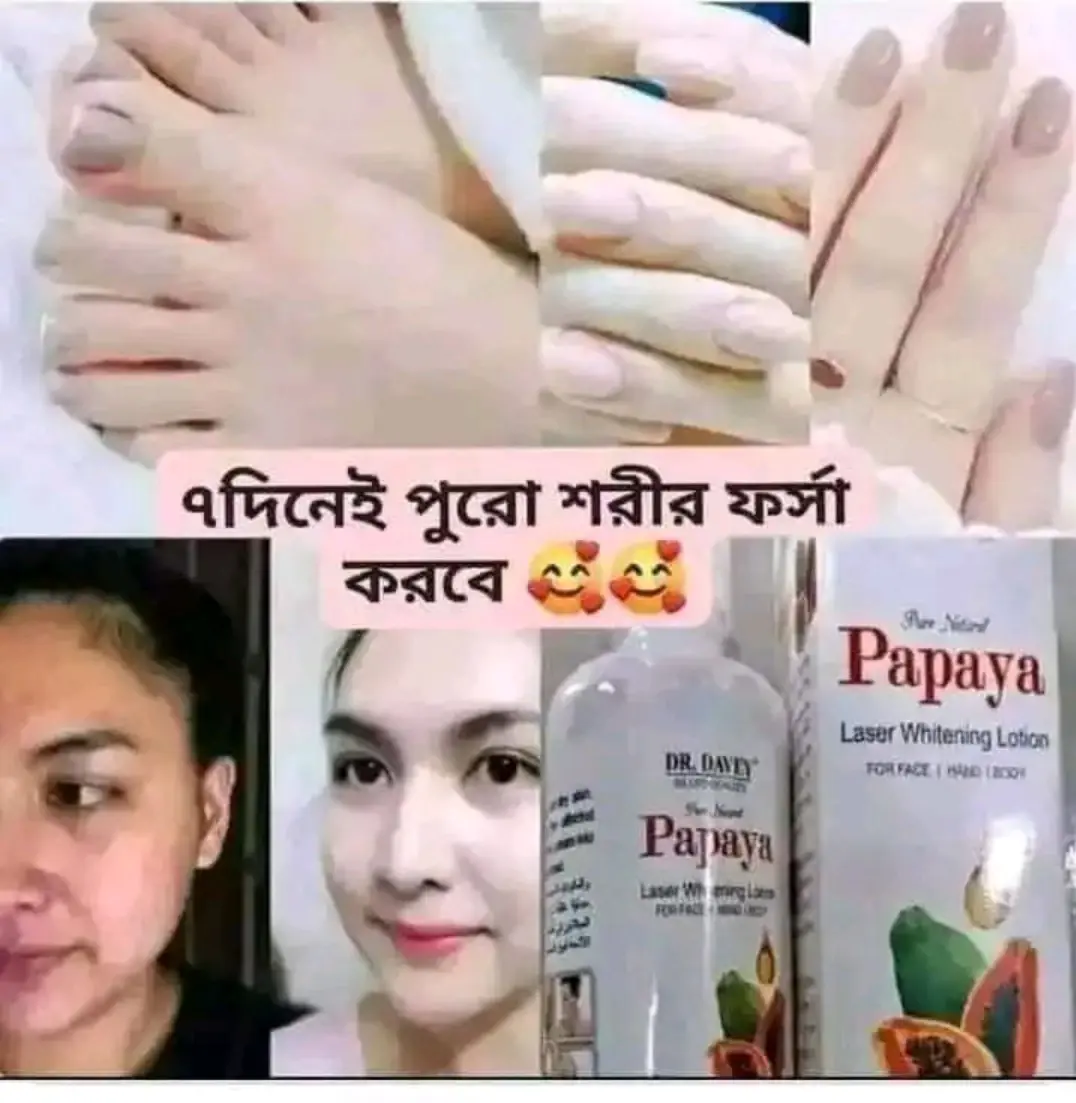 Picture of Dr Davey Papaya Laser Body Whitening Moisturizer Lotion