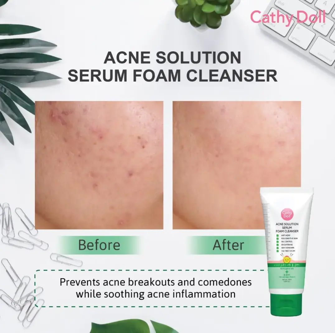 Picture of Acne Solution Serum Foam Cleanser 100ml Cathay Doll Face Wash(Made In Korea)