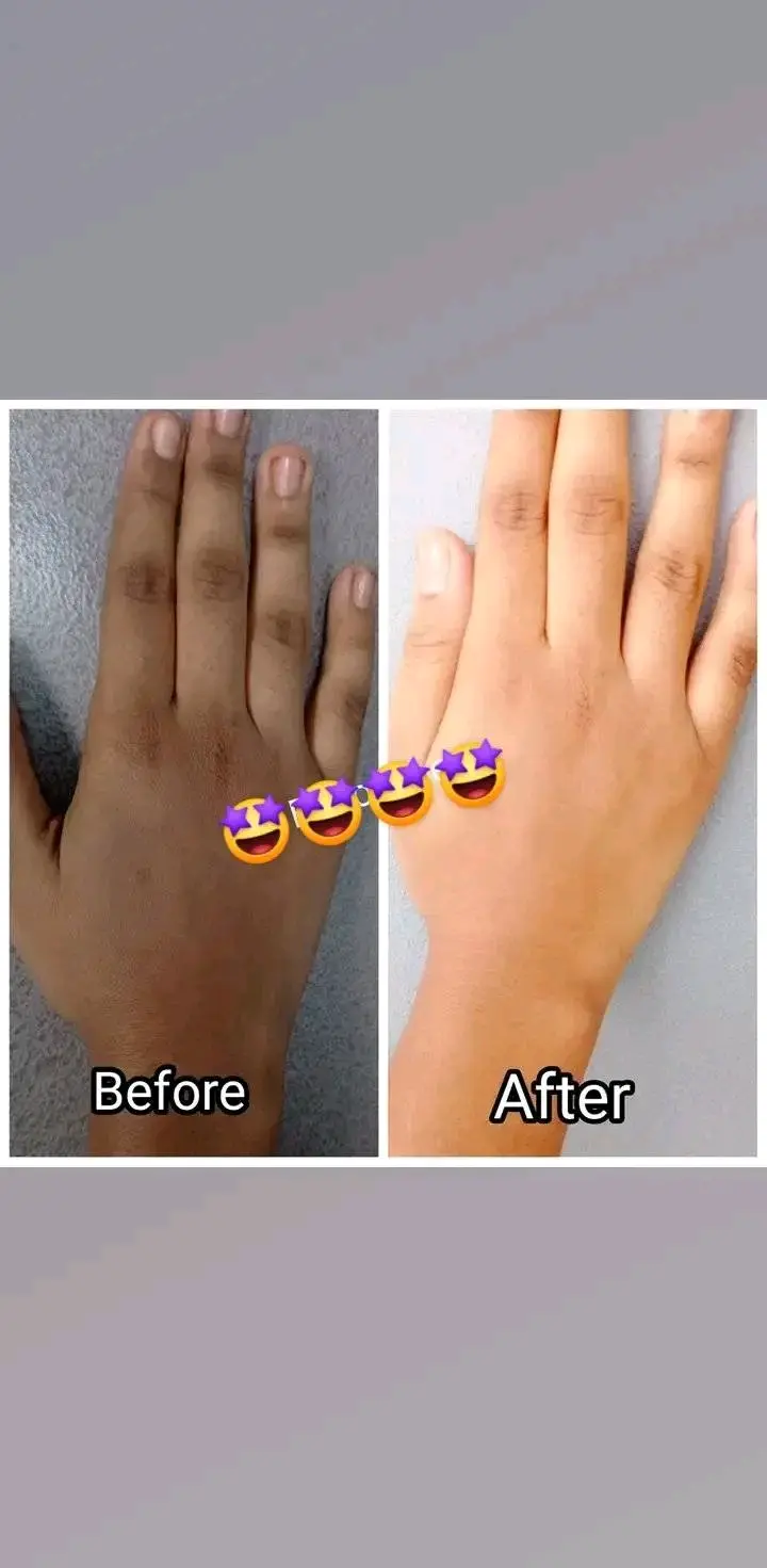 Picture of Cherry & Saffron Body Whitening Cream for 10x Body Lightening  - 300gm