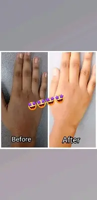 Picture of Cherry & Saffron Body Whitening Cream for 10x Body Lightening  - 300gm