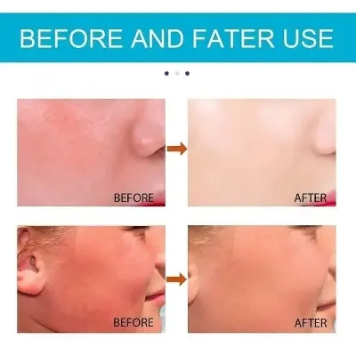 Picture of JAYSUING SPF 50+ Moisturiser Sun Stick - 20gm - Blue