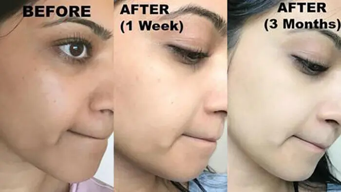 Picture of Osufi Gold Whitening Mini Serum