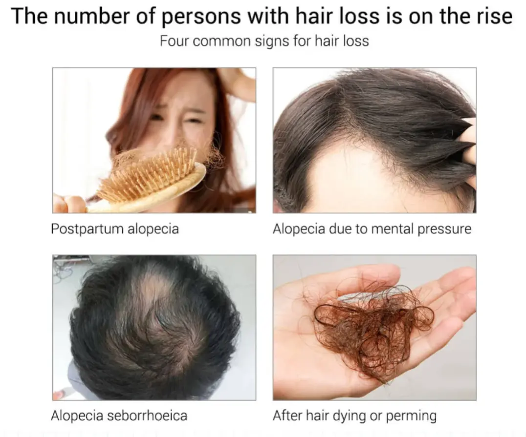 Picture of MORFOSE Milk Therapy Keratin Hair Serum - 100ml